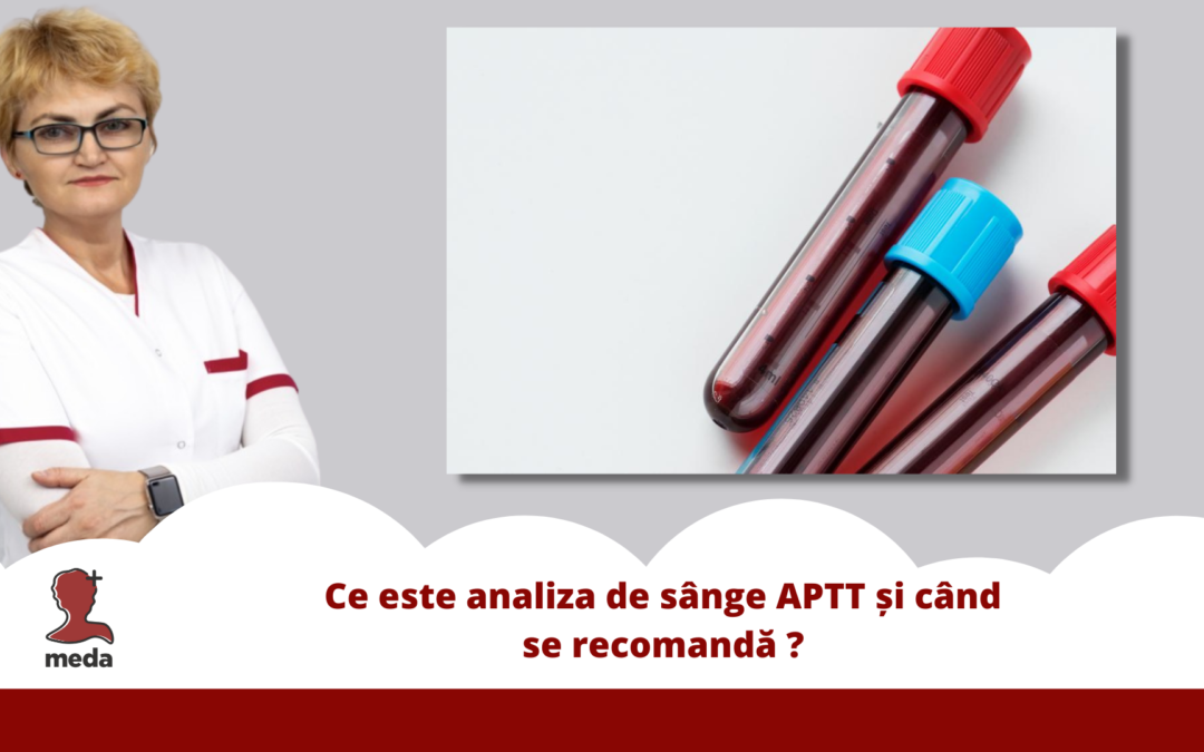 Ce este analiza de sange APTT si cand se recomanda ?