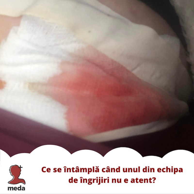 Strataderm vs Stratamed - Tratamente la domiciliu - Ce se intampla cand unul din echipa de ingrijiri nu e atent?