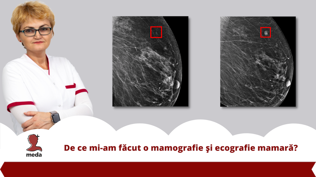 De ce mi-am facut 👉 o mamografie si ecografie mamara?