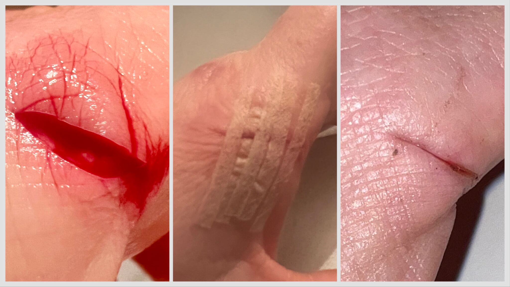 Tratamente la domiciliu - Tratarea ranilor - De ce diplomele 👉 conditioneaza insasi existenta umana?