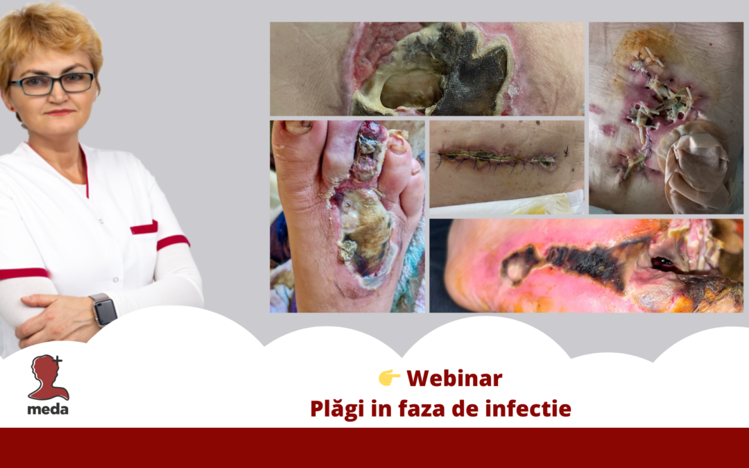 Webinar 👉 Plagi infectate sau in faza de infectie