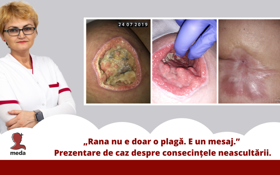 Rana nu e doar o plagă. E un mesaj. - Poza articol