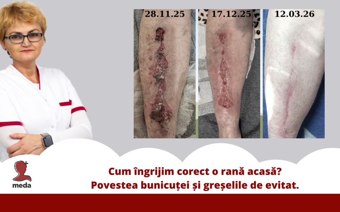 Cum îngrijim corect o rană acasă? Povestea bunicuței și greșelile de evitat.