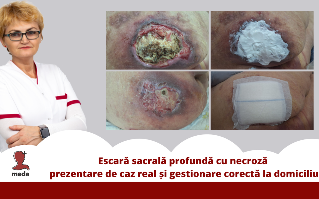 escara sacrala profunda necroza tratament